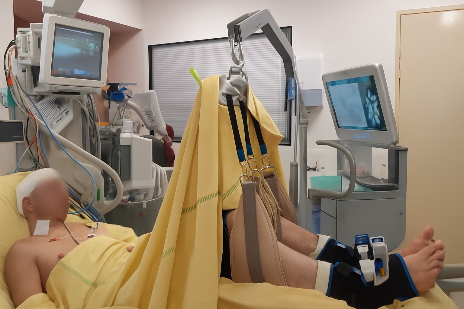 Vibramoov en réanimation